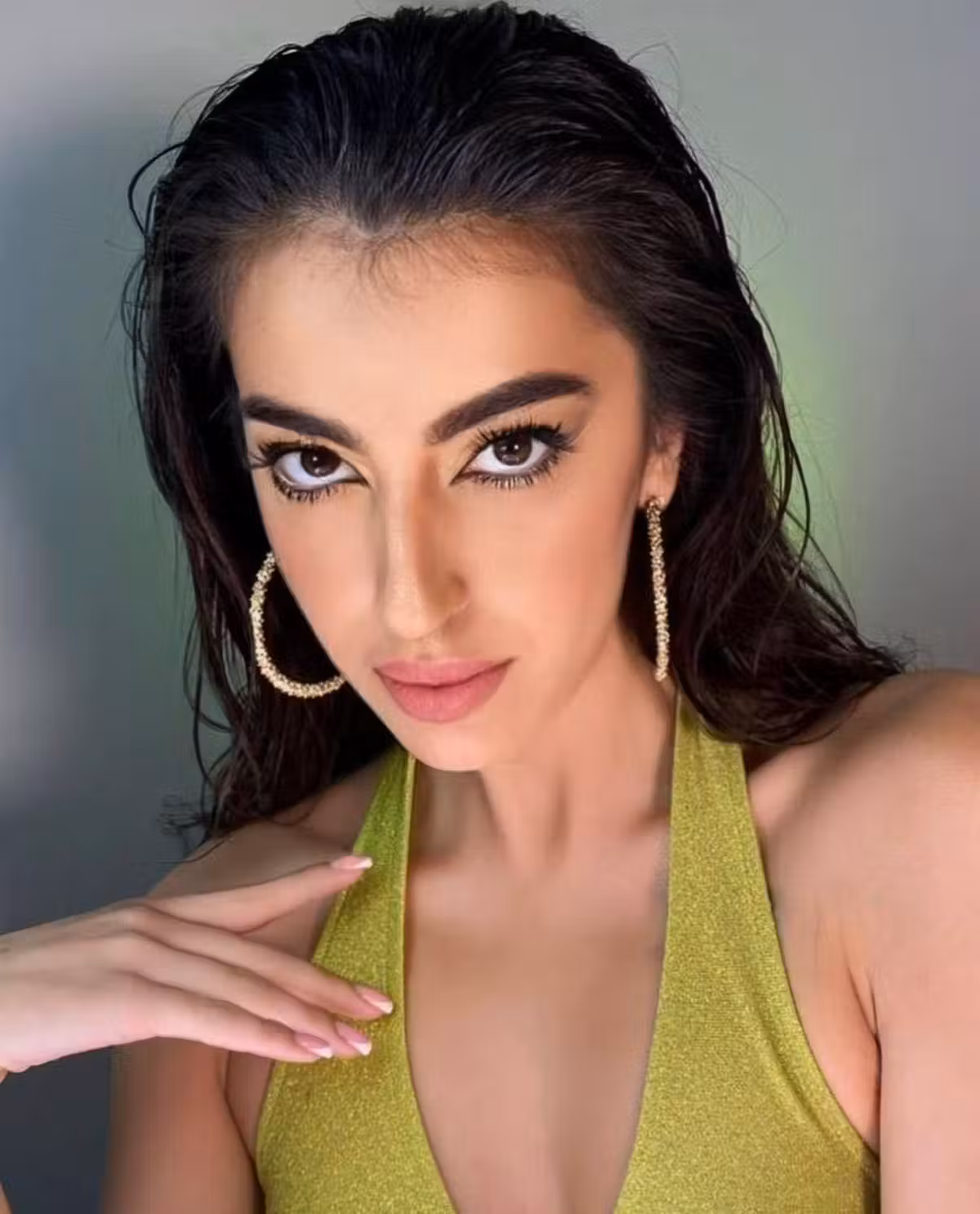 Albina